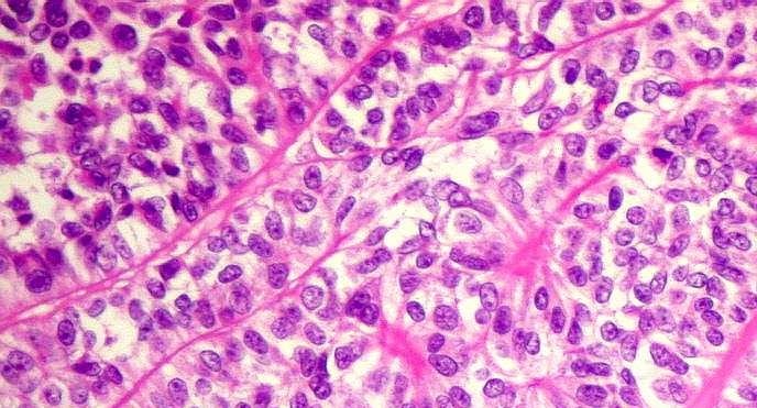 DSCN38799+ DSCN38799 1