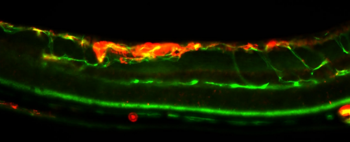 assinatura-genetica-cancer-de-mama assinatura genetica cancer de mama