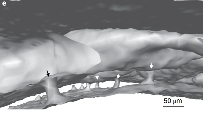 cerebro cranio tunel 2