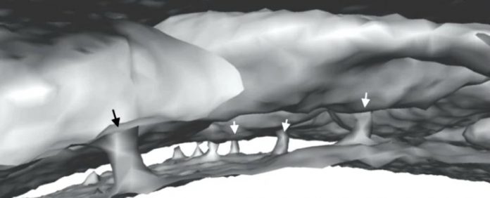 cerebro-cranio-tunel cerebro cranio tunel