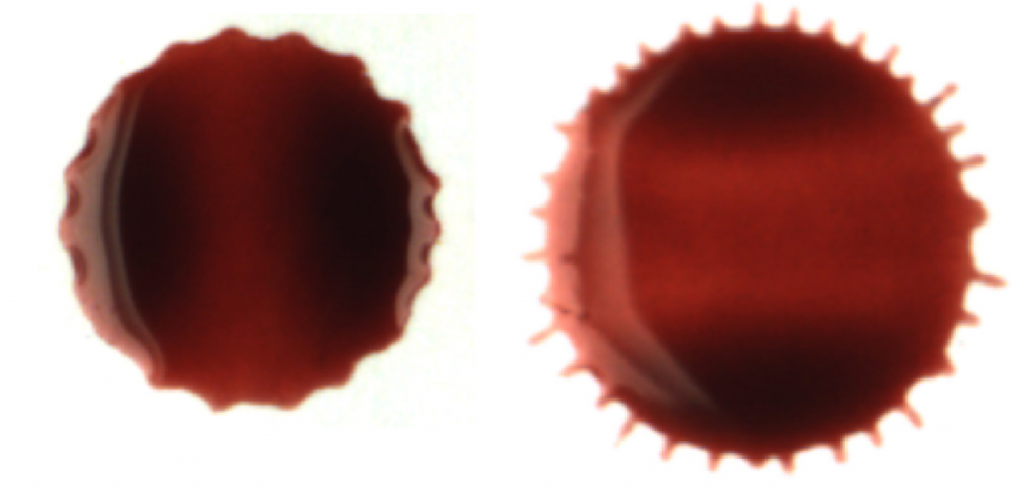 mancha perpendicular